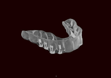 Laptop placed in the circle, on the black background, with visible teeth scans